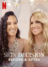 Skin decision: prima e dopo (2020) - Serie TV Streaming HD